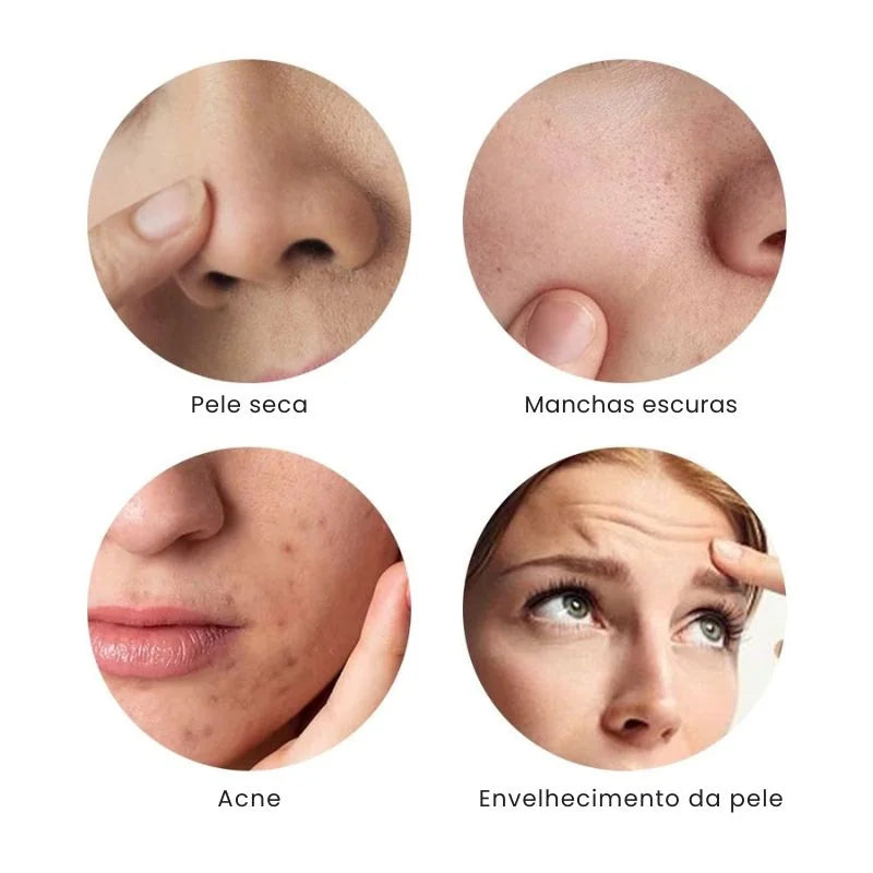 Aparelho de lifting facial com luz vermelha e azul para rejuvenescimento